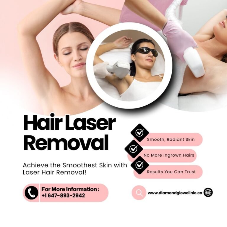 Best laser hair removal brampton 4 1 768x768