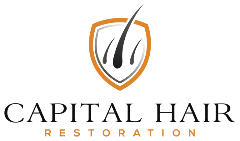 xCapital Hair Restoration Logo.png.pagespeed.ic .BNimHWqHS6 768x452