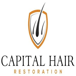 xCapital Hair Restoration Logo.png.pagespeed.ic .BNimHWqHS6 Copy