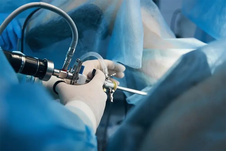 Spinal stenosis surgery in San Antonio TX 768x512